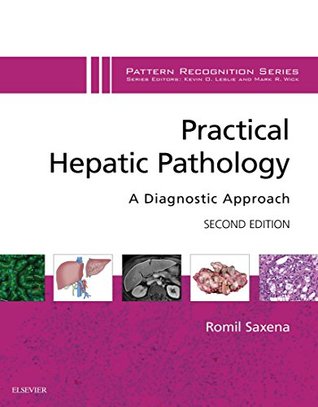 Full Download Practical Hepatic Pathology: A Diagnostic Approach E-Book: A Volume in the Pattern Recognition Series - Romil Saxena | ePub