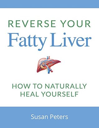 Full Download Reverse Your Fatty Liver: How to Naturally Heal Yourself - Susan Peters file in PDF